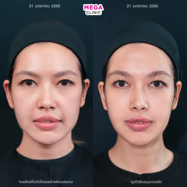 รีวิว HArmonyCa