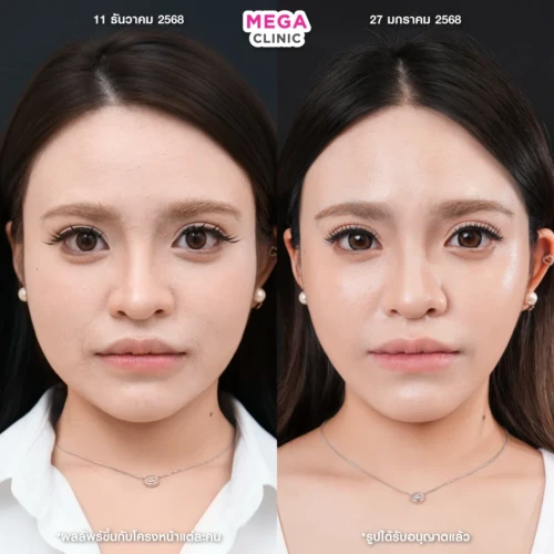 รีวิว Oligio