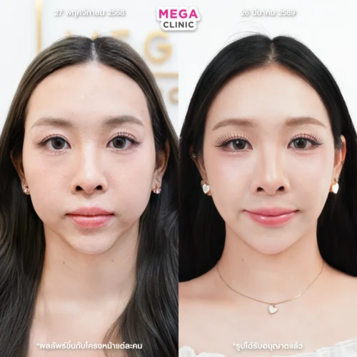 รีวิว Oligio