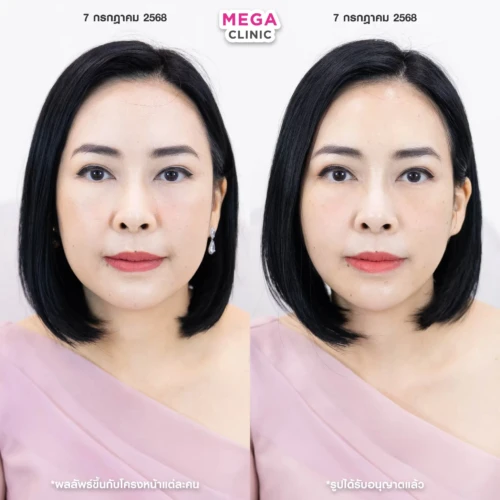 รีวิว Oligio