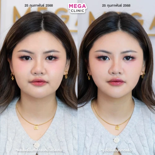 รีวิว Oligio